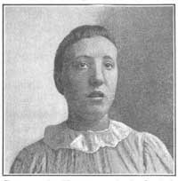 FIG. 23.&mdash;Intelligent expression is often lacking in children with adenoid growths.