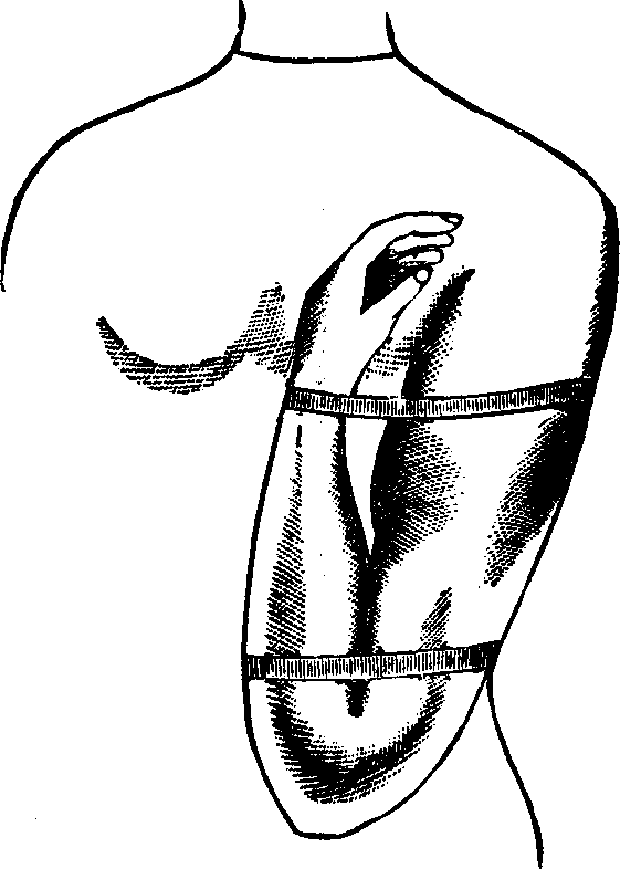 Illustration:
Fig. 2. Mode of employing flexion for the arrest of hemorrhage from a wound
located below the elbow.